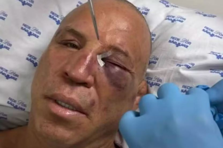 Wanderlei Silva quebra nariz e leva pontos após sofrer ‘nocaute’ na confusão depois da luta contra Popó wanderlei-silva-quebra-nariz-e-leva-pontos-apos-sofrer-‘nocaute’-na-confusao-depois-da-luta-contra-popo